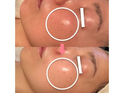 アンジェラックス 福岡天神店の写真