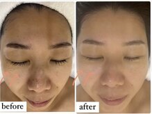 ミルジュ(MiLuJu)/マーメイドトリートメント