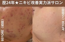 サロンドエクラ 南堀江(salon de eclat)