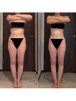 エミナル(EMINALu)/骨盤の歪み