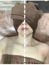 エミルカ 仙台(EMILUCA)/美姿勢＆美顔筋リフト