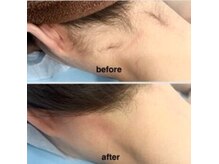 気になるパーツのみOK。予算に合わせて自分でカスタマイズ☆