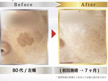 マシロ(MA SHIRO)/気になるシミまでケア