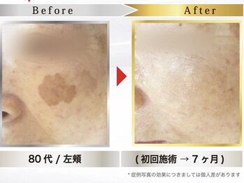 マシロ(MA SHIRO)/気になるシミまでケア