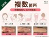 迷ったらこれ【術後ケア】インディバ100分◆腫れ/内出血/固さ DTケア￥17000→