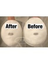 美極 銀座店/銀座/小顔コルギ/小顔矯正