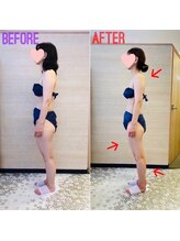 エステティックサロン アール 大阪梅田(esthetic salon R)/40代女性　横