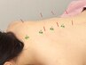 【はり・お灸】更年期症状など女性特有のお悩み改善にも★