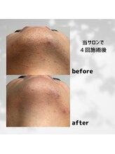 パーミル 楠葉店(per mille‰)/Before/After