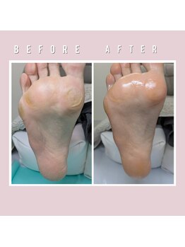 巻き爪補正店 大阪なんば店/足裏トータルケア