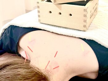 東合川はりきゅう整骨院の写真/【鍼灸＋もみほぐし】当店人気のセットメニュー★鍼灸が初めての方にもオススメ！身体の不調にアプローチ◎