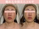セレソル(CERESOL)の写真