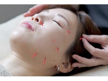 ハリノヒ 本町院/電気を流す美容鍼