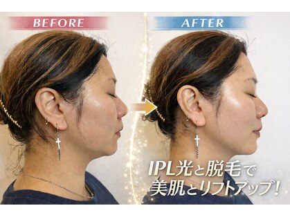 ガーベリー(GerbeLy)の写真