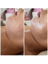 private salon Ponola【ポノーラ】/バンテージ