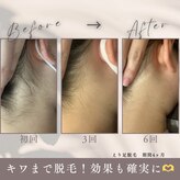 モアトゥインクル 福山宮通り店(MORE twinkle)