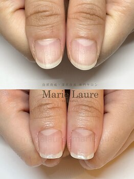 マリーロール 淀屋橋本店(Marie Laure)/自爪育成/深爪矯正/ネイルケア