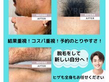 ブライト(BRiGHT)の雰囲気（本気で結果を出したい方は是非ブライトへ！脱毛卒業できます！）