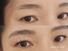 ウミカ(umica)/ブロウリフトで今風顔に