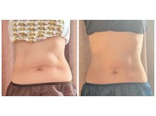 ダノンナモモエ(Da Nonna momoe)/レモンボトル今だけお得