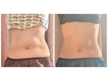 ダノンナモモエ(Da Nonna momoe)/レモンボトル今だけお得