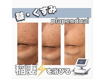 アンド リュクス(& Luxe)/☆プラペンご紹介☆