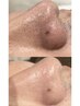 【小鼻の産毛、角質除去】小鼻WAX &眉毛WAX