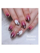 トレジャー(treasure)/