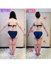 エステティックサロン アール 大阪梅田(esthetic salon R)/40代女性　後