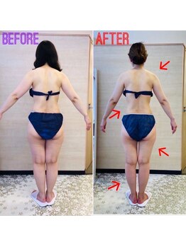 エステティックサロン アール 大阪梅田(esthetic salon R)/40代女性　後