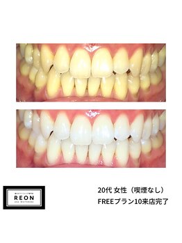 レオン 磐田(REON)/◇ お客様 before＆after ◇
