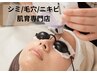 痛みの少ないシミ毛穴ケアコース