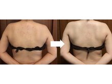 ヴァン ベール 那覇店/背中美肌ケア