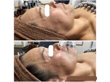 テラスアップ(Terrace UP)