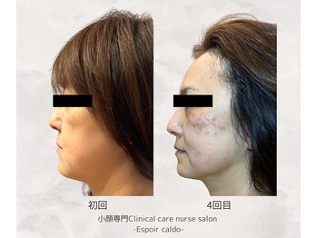 エスポワールカルド(Espoir caldo)/