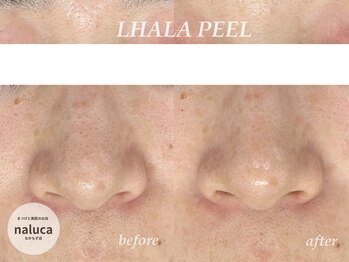 ナルカ(naluca)/【堺市・中百舌鳥】ララピール