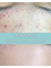 シェリール 大宮(cherir)&nbsp;根本改善に ハーブの力