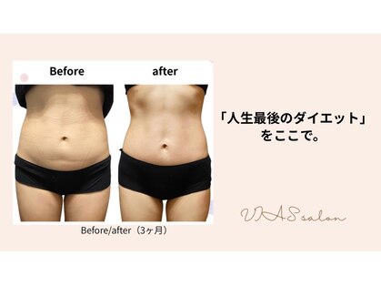 ヴィアス(VIAS)の写真