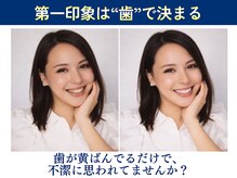 ホワイトニングショップ くずは店の雰囲気(ホワイトニングするだけで第一印象は良くなる♪まずはお試し◎)