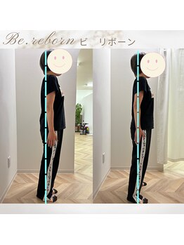 リボーン(Be.Reborn)/施術後