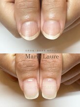 マリーロール 淀屋橋本店(Marie Laure)/自爪育成/深爪矯正/ネイルケア