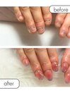 ◆深爪矯正+長さだしアート◆