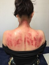 イミューンプラス(immune+)