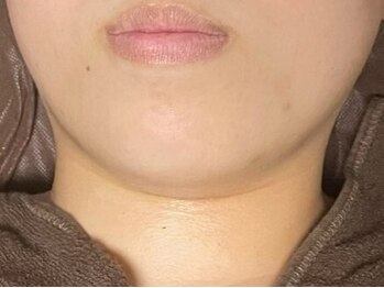 コマチ(comachi)の写真/細胞を活性化しお肌のターンオーバーの正常化を促進◎内側からみずみずしいハリとツヤ、弾力・透明感UP♪