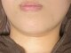 コマチ(comachi)の写真/細胞を活性化しお肌のターンオーバーの正常化を促進◎内側からみずみずしいハリとツヤ、弾力・透明感UP♪