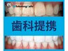 【歯科提携★】　プレミアムセルフホワイトニングカウンセリング