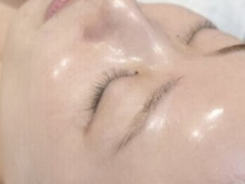 白美の写真/【シミを改善し美白化◎】 ララピールを超える最新の第5世代ピーリングで、あなたのお肌を美白に導きます★