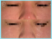 ヴィオール 名古屋栄店(VIOR)/韓国大人気　ララピール