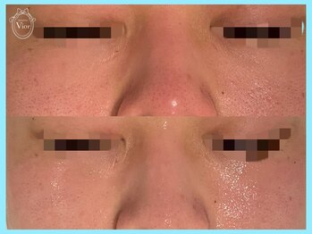 ヴィオール 名古屋栄店(VIOR)/韓国大人気 ララピール