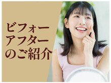 ミナミ(MINAMI)/ビフォーアフターのご紹介